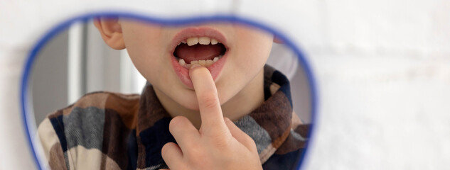 Little boy looking in the mirror at his loose primary tooth.