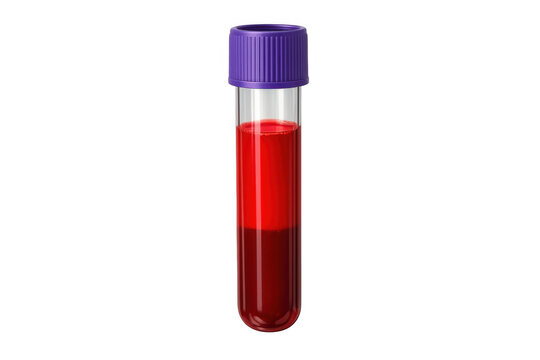 Blood sample in medical test tube with purple cap, representing health analysis, laboratory research, and diagnostic testing