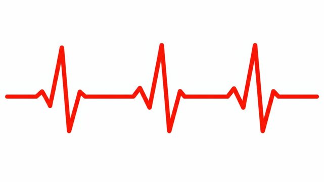 Red heart beat line animation showing a normal sinus rhythm on a display screen. Medical ekg pulse wave for cardiology, healthcare and hospital diagnostic technology