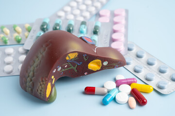 Liver model with pill drug treatment, Cirrhosis, Liver cancer, fatty liver.