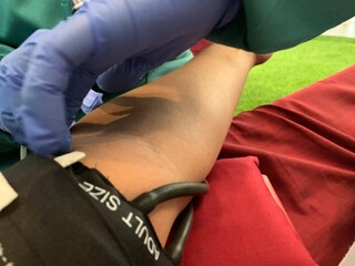 Medical professional wearing blue gloves inserting needle into patient. Person lying on medical chair with intravenous drip attached to their arm for blood transfusion or donation.