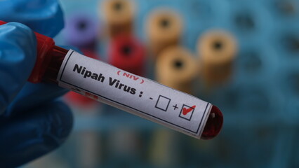 Obraz premium The Nipah virus is a zoonotic virus that primarily affects animals, particularly fruit bats, but can also infect humans and other animals.