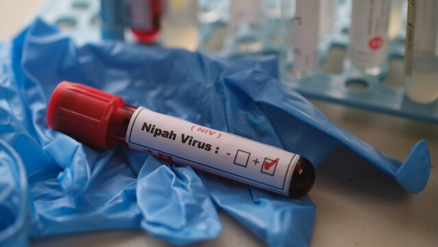 The Nipah virus is a zoonotic virus that primarily affects animals, particularly fruit bats, but can also infect humans and other animals.