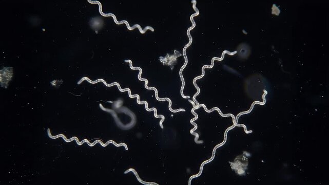 Lyme disease spirochetes floating in a liquid. Microscopic photo of a spirochete of Lyme disease bacteri.