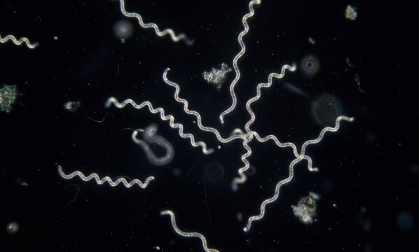Lyme disease spirochetes floating in a liquid. Microscopic photo of a spirochete of Lyme disease bacteri.