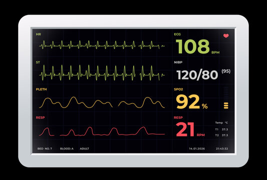 Vector illustration of medical ECG monitor interface displaying ecg, spo2 and respiration indicators for patient vital signs monitoring in modern healthcare system