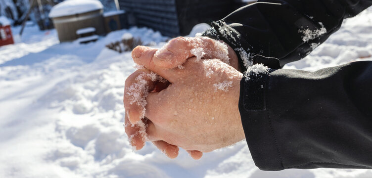 Male hands without gloves in winter.Risk of frostbite of hand outdoors during cold weather because of frost in winter.