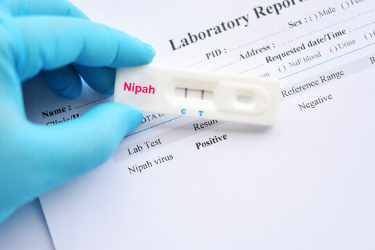 Nipah virus test positive by using rapid test kit
