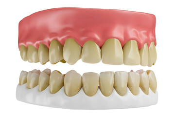 Obraz premium Dental denture model with upper and lower teeth on a black background