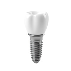 A dental implant on a white background, suitable for medical or educational uses