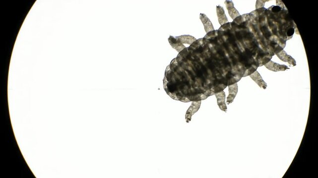 Microscopic View of Tardigrade.