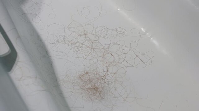 Losing hair falling onto a white bath signals potential health problems such as alopecia or telogen effluvium
