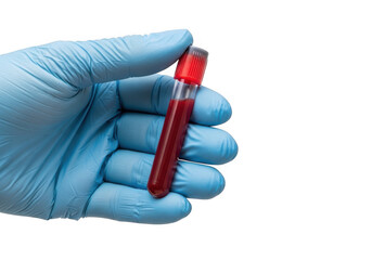 Medical professional holding a blood sample in a test tube