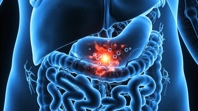 Medical visualization of stomach cancer development with inflamed area representation