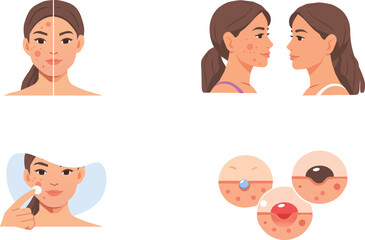 Obraz premium Acne Treatment Vector Set Before After Skincare Process Illustration