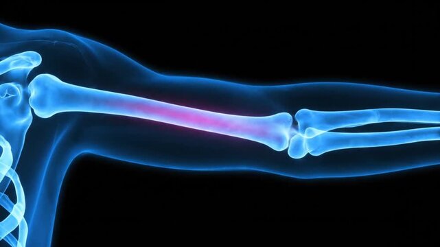 X-ray of Human Arm Bones.