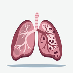 Illustration of healthy and diseased human lungs, showing damage or illness in one lung.