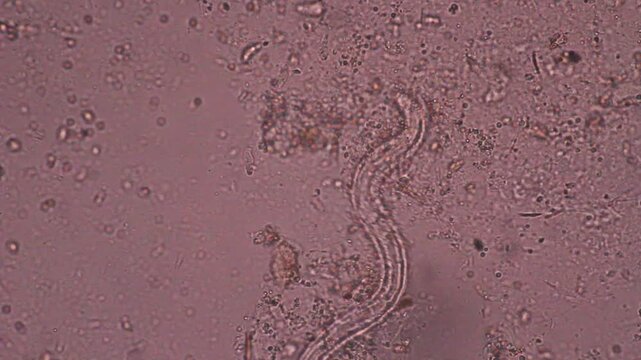 View in microscopic Strongyloides stercoralis or threadworm in human stool.Parasite or fluke infection.Medical background analyze by microscope, original magnification 400x