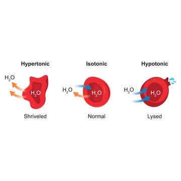 Red Blood Cells Osmosis Diagram: Hypertonic Isotonic and Hypotonic Solutions