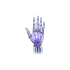 Naklejka premium Medical illustration of a human hand with highlighted wrist joint
