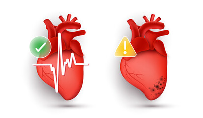 Healthy vs unhealthy human heart anatomy comparison with heartbeat ECG line, green check mark and yellow warning alert sign. Vector illustration for cardiology, medical diagnosis and risk concept.