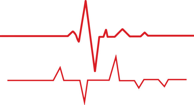 Dual electrocardiogram waveforms demonstrating heart rate variability and rhythm patterns