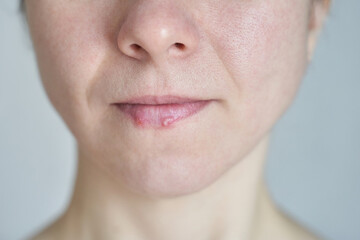 Obraz premium Close-up of mature caucasian female with chapped lips and natural skin texture highlighting beauty and skincare concerns.