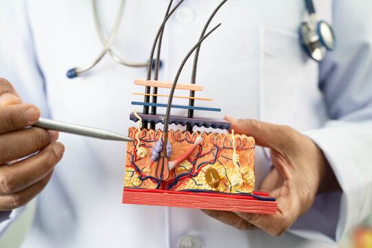 Hair transplant, Asian dermatologist doctor holding skin structure anatomy model for treatment in hospital.