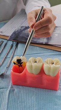 Doctor demonstrates dental procedure using practice model with teeth on blue cloth