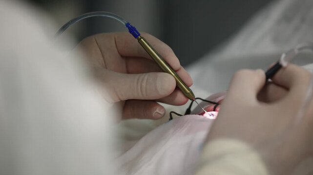 Doctor ophthalmology surgeon cataract removal, examines fundus in microscope, patient under sterile cover.