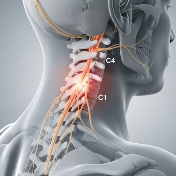 Cervical Spine Pain - Anatomy of Neck and Nerve Damage.