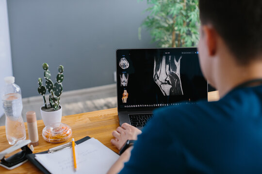 Doctor examining knee mri scan on laptop