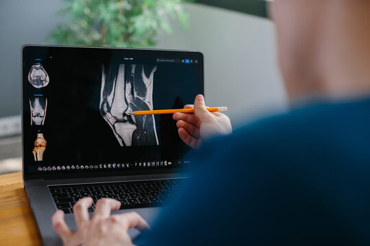 Doctor analyzing knee mri scan on laptop
