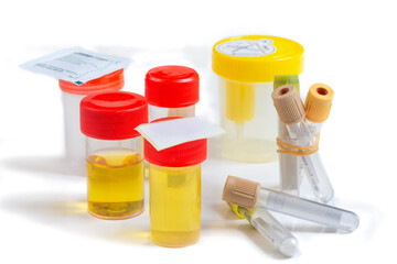 Lab Medical Test Container Collection