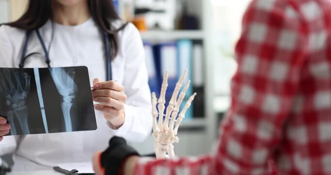 Woman doctor holds wrist X-ray explaining complex fracture risk. Patient looks at skeleton model considering surgery treatment choice carefully