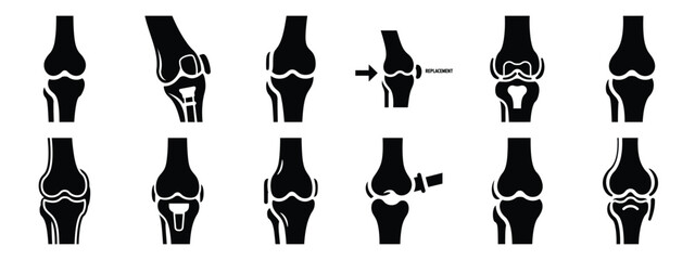 Minimalist black silhouette icon set of a joint replacement . simple black flat vector style for medical and fitness icons concept.