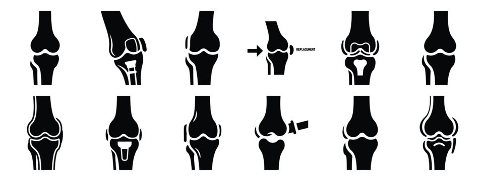 Minimalist black silhouette icon set of a joint replacement . simple black flat vector style for medical and fitness icons concept.