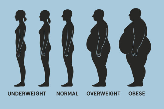 Obesity BMI Chart Comparison Flat Vector