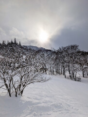 Winter landscape featuring a snowy slope and forest silhouette against bright sun