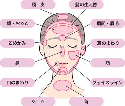 ニキビができやすい場所マップ
