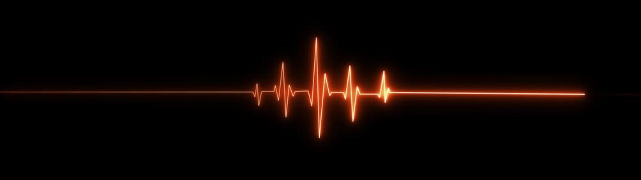 Futuristic neon blue ECG heartbeat line on a black background, with a central cluster of sharp pulse spikes and smooth flat lines on both sides. Digital medical waveform design symbolizing heart