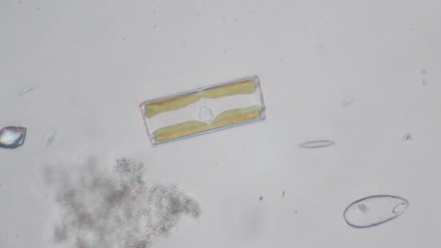 diatoms, freshwater diatom, microscopic photo, algae, Monza, Lambro Valley regional park, Monza, microscopic photo, algae,  freshwater diatoms, diatom,