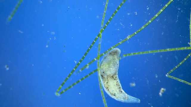 Flatworm under the microscope at 40x Magnification