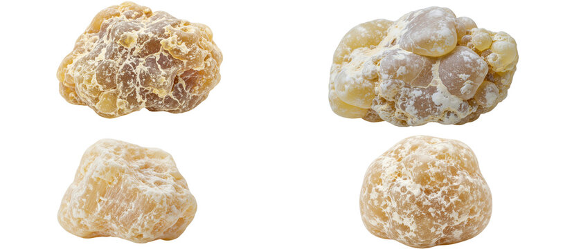 A collection of four different human kidney stones isolated on a white background.
