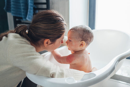 Atopic dermatitis skin care. Mother bathing her daughter with eczema. Mom taking care of infant baby at home