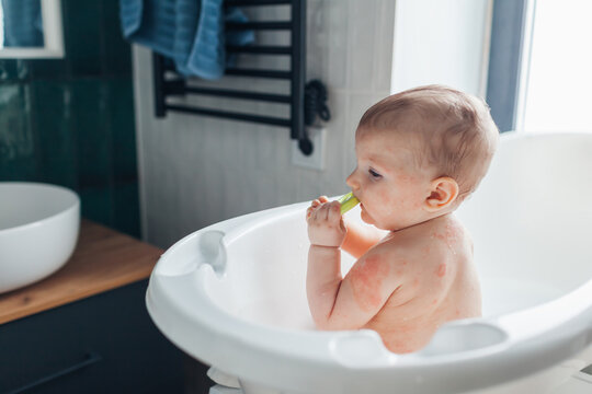 Atopic dermatitis skin care routine. Bathing little baby girl with eczema. Red dry itchy spots on child's body. Taking care of kid