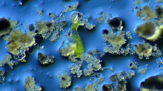 Euglenids and other microorganisms under the microscope at 100x Magnification