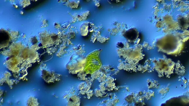 Euglenids and other microorganisms under the microscope at 100x Magnification