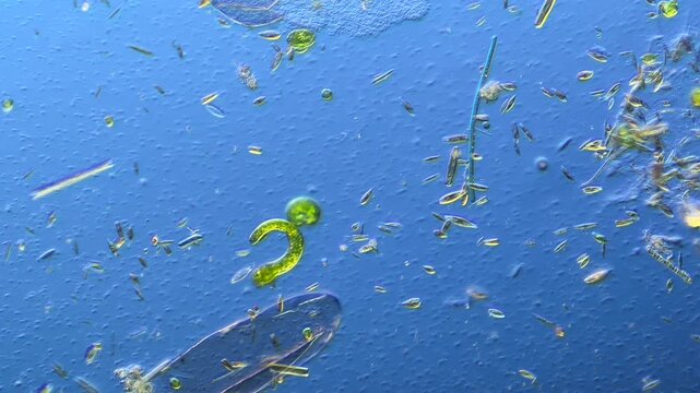 Euglenids and other microorganisms under the microscope at 100x Magnification