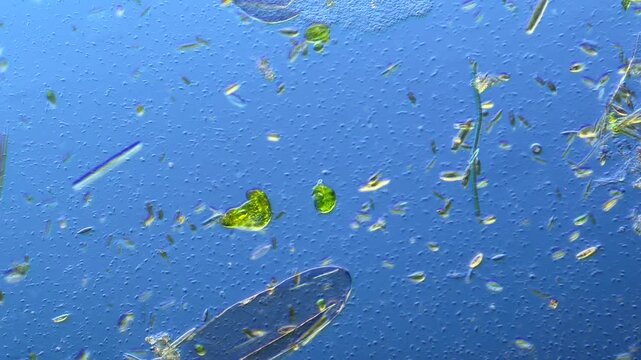Euglenids and other microorganisms under the microscope at 100x Magnification
